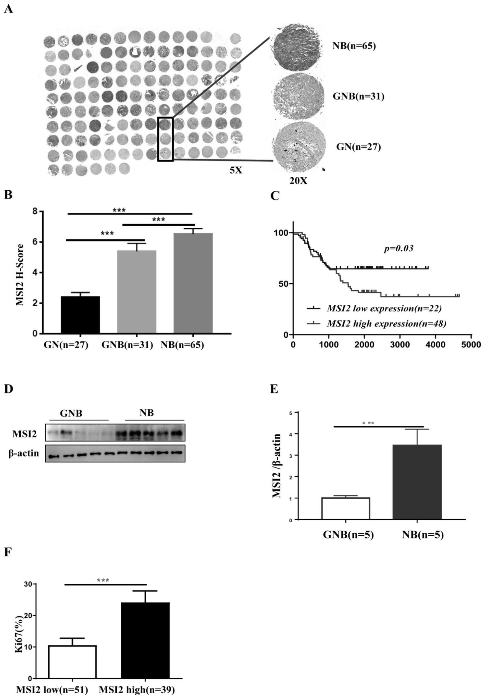 RNA结合蛋白Musashi在神经母细胞瘤诊断和预后中的应用
