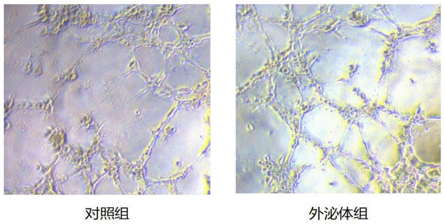 一种工程化促血管生成外泌体及其制备方法和应用与流程