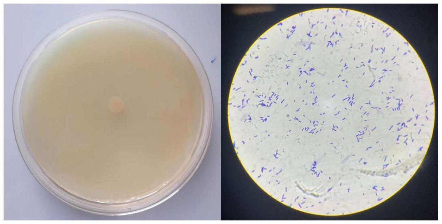 解淀粉类芽孢杆菌的用途的制作方法