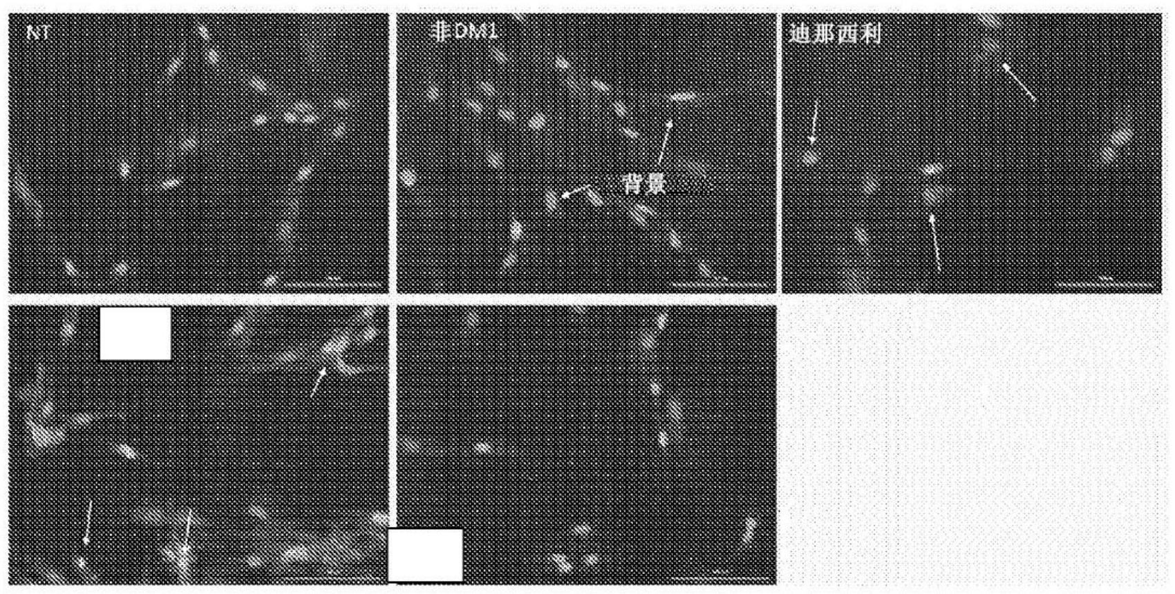 用于调节强直性肌营养不良1型的方法和化合物与流程