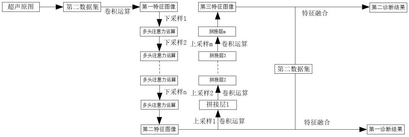 一种淋巴结超声图像分类方法