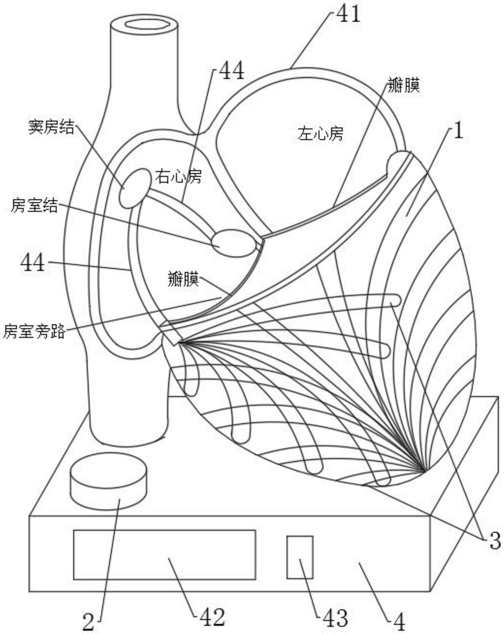 一种心室预激演示模型的制作方法