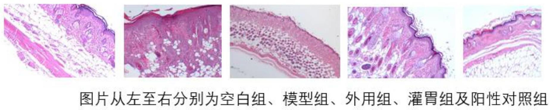 青藤碱在制备治疗特应性皮炎产品中的应用