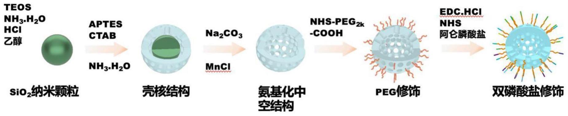 负载姜黄素的掺锰中空介孔二氧化硅纳米颗粒及其在牙周骨组织修复中的应用