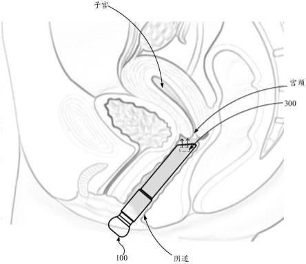 阴道检查装置的制作方法