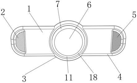 一种新生儿护脐带及其制备方法与流程