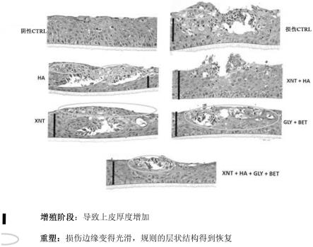 眼用组合物及其在眼睛疾病治疗中的应用的制作方法