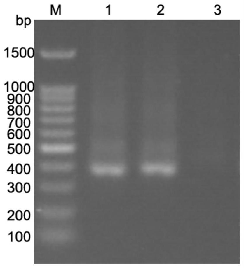 检测低微生物量生物样本中细菌的引物组合、试剂盒及方法与流程