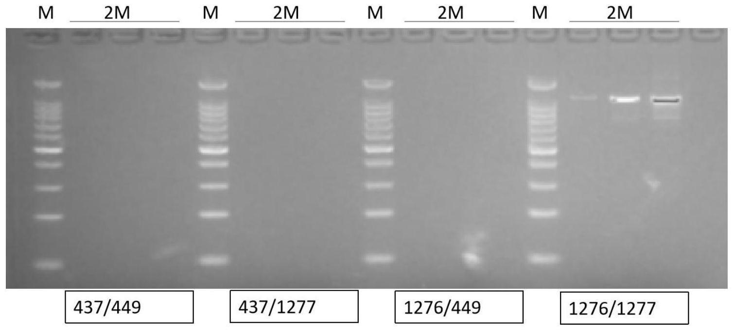 一种检测青花菜强自交不亲和系2M的SP11基因的引物及其应用的制作方法
