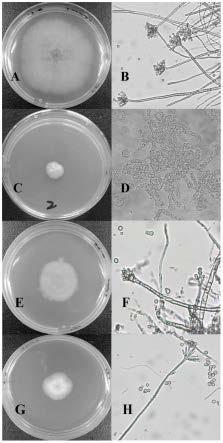 激酶基因在调控丝状真菌菌丝形态中的应用