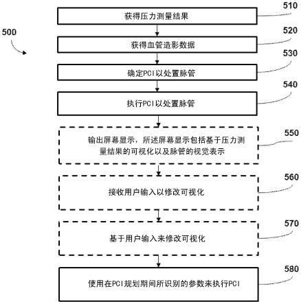 经皮冠状动脉介入（PCI）规划接口以及相关联的设备、系统和方法与流程