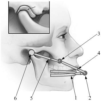 一种颞下颌关节髁状突体外位置标定装置