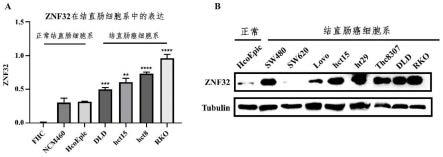 抑制ZNF32基因表达在制备结直肠癌药物中的应用的制作方法