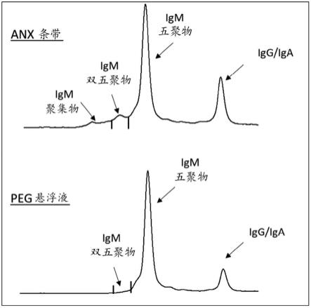 用于获得包含人血浆来源的免疫球蛋白M的组合物的方法与流程
