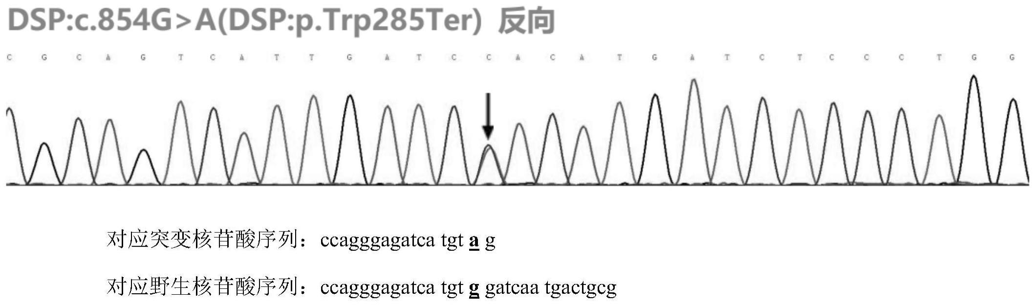 致心律失常右室发育不良心肌病DSP变异基因及其应用的制作方法