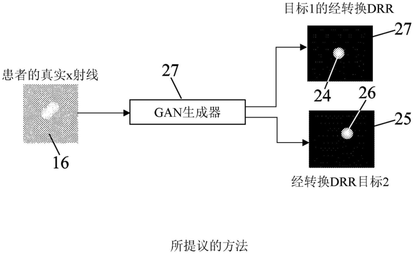 医学成像转换方法和相关联的医学成像3D模型个性化方法与流程