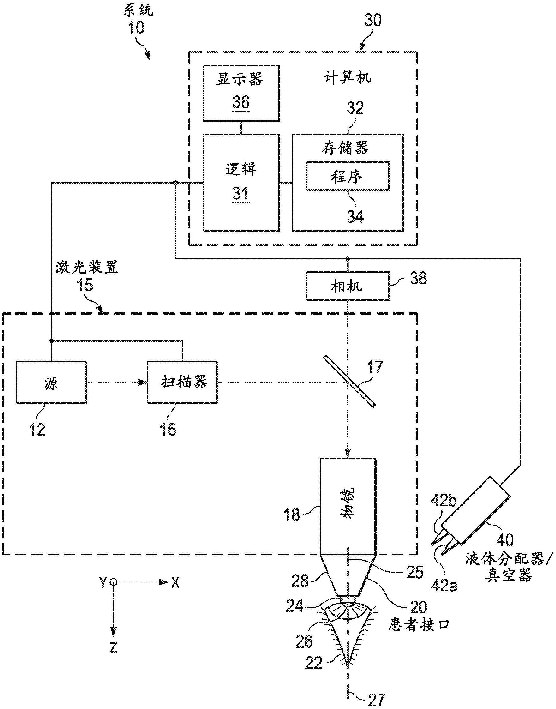 用于将眼睛与眼科激光装置的患者接口对准的系统的制作方法