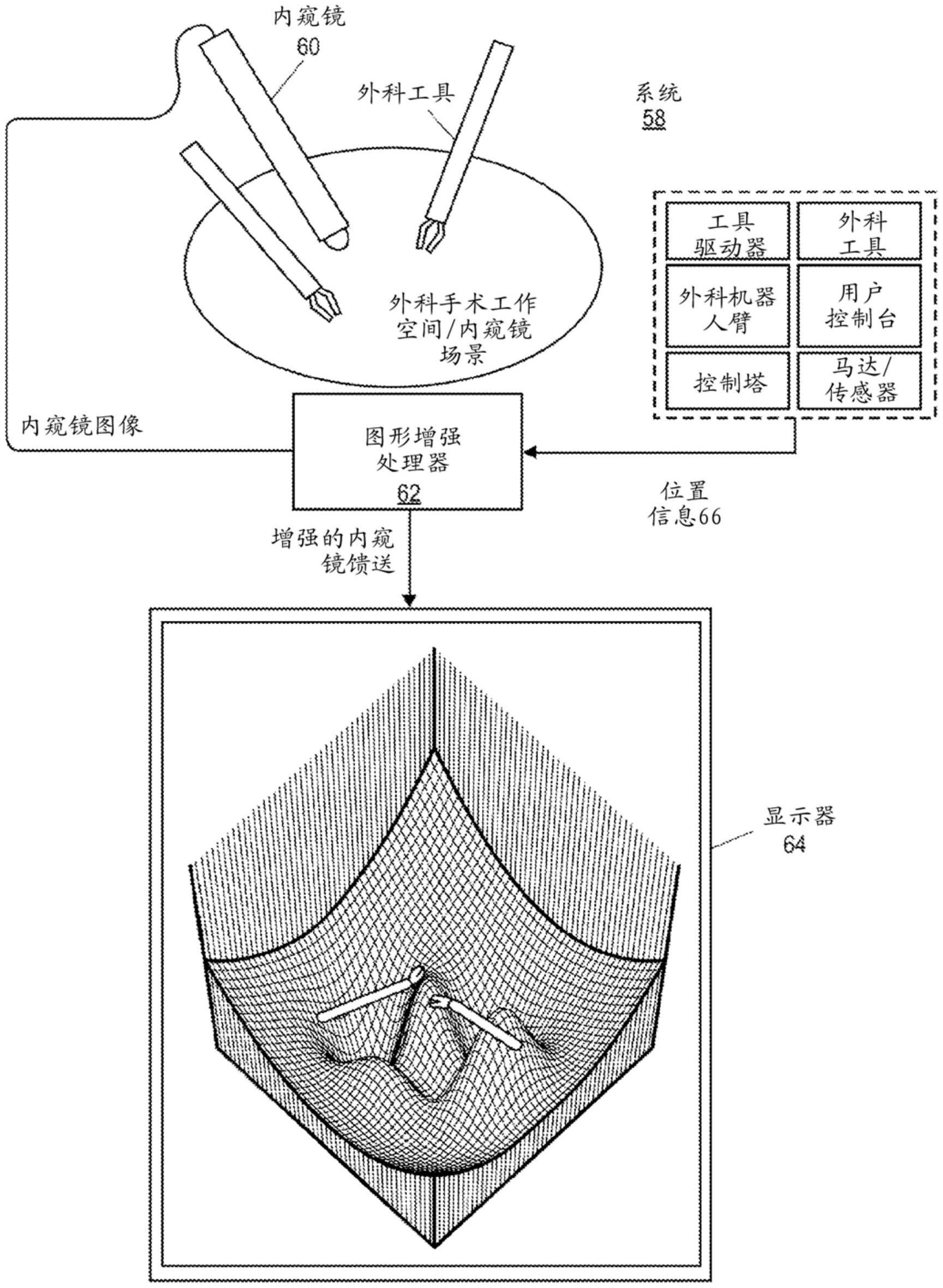 用于内窥镜系统中的深度感知和碰撞避免的3D可视化增强的制作方法