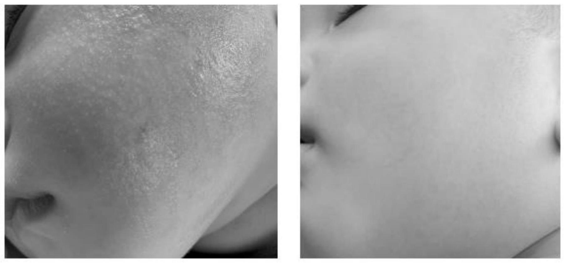 婴儿干燥性湿疹图片（宝宝湿疹反复发作）-幼儿百科-魔术铺