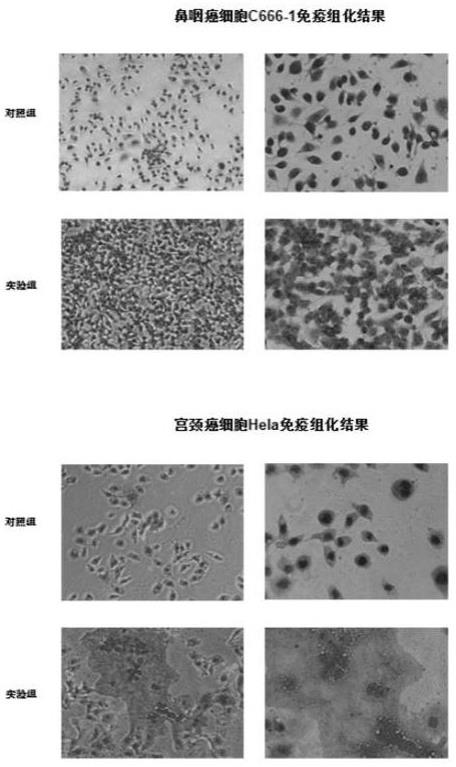 一种用于治疗鼻咽癌的单克隆抗体FHY-001及其应用的制作方法