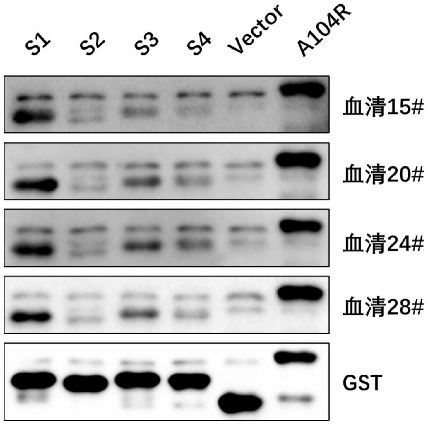 非洲猪瘟病毒pA104R蛋白免疫优势性B细胞抗原表位及其单克隆抗体与应用