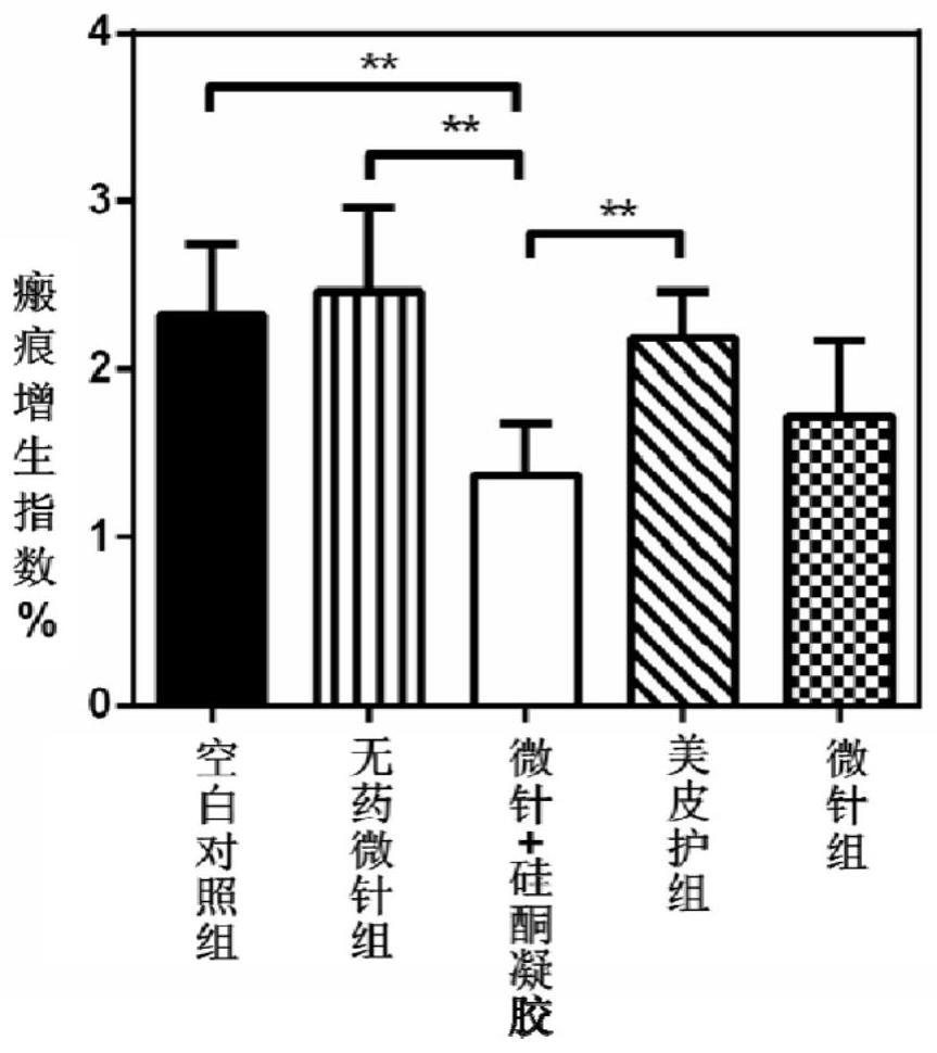 一种背覆硅酮凝胶的载药微针贴片的制备方法及其应用