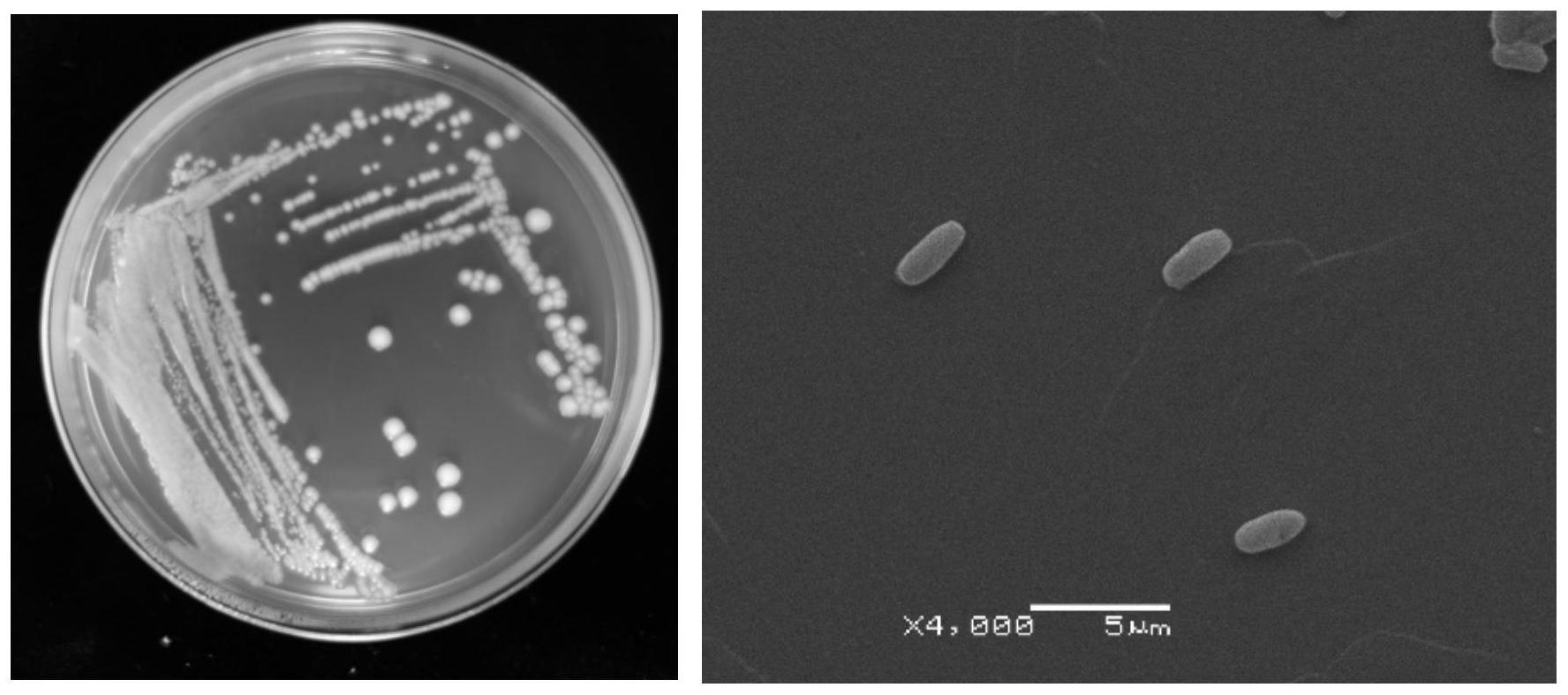 检验规培成长记-微生物检验之培养基菌落的观察 - 知乎