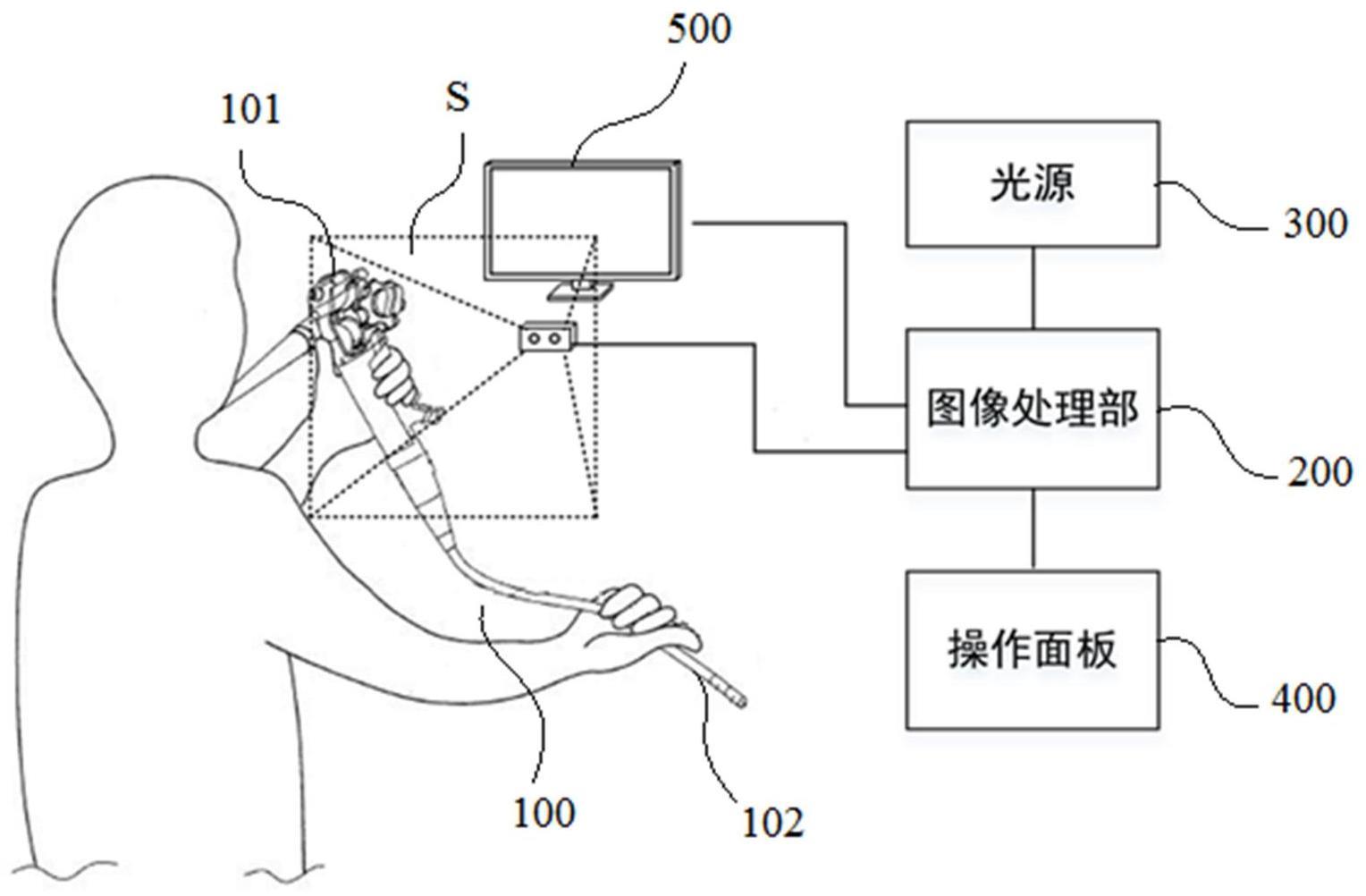 内窥镜操作系统的制作方法