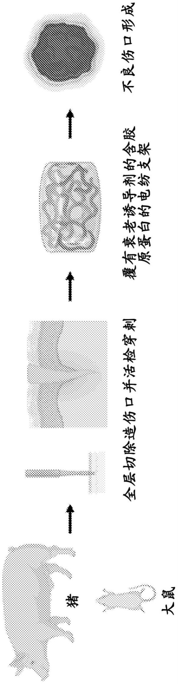 伤口愈合模型