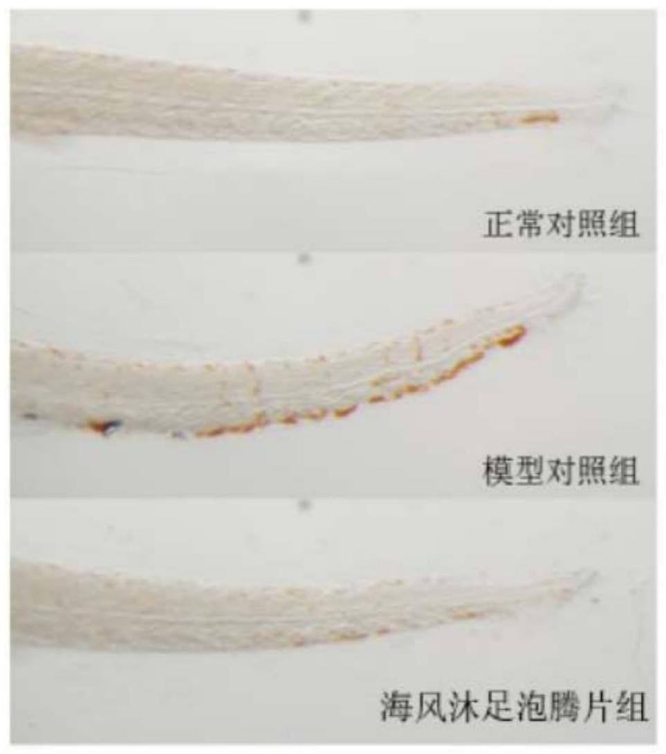 一种治疗脾肾阳虚型足骨痛的中药组合物及其制备方法与流程