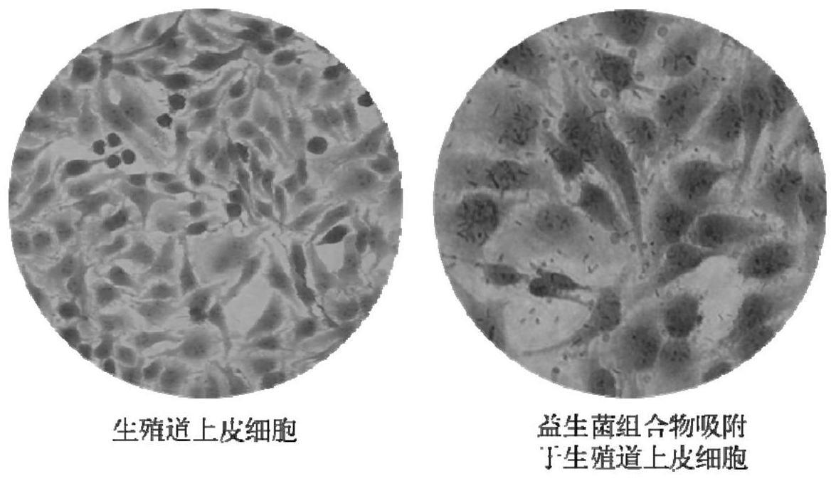 一种缓解或改善念珠菌性阴道炎的益生菌组合物及其应用的制作方法