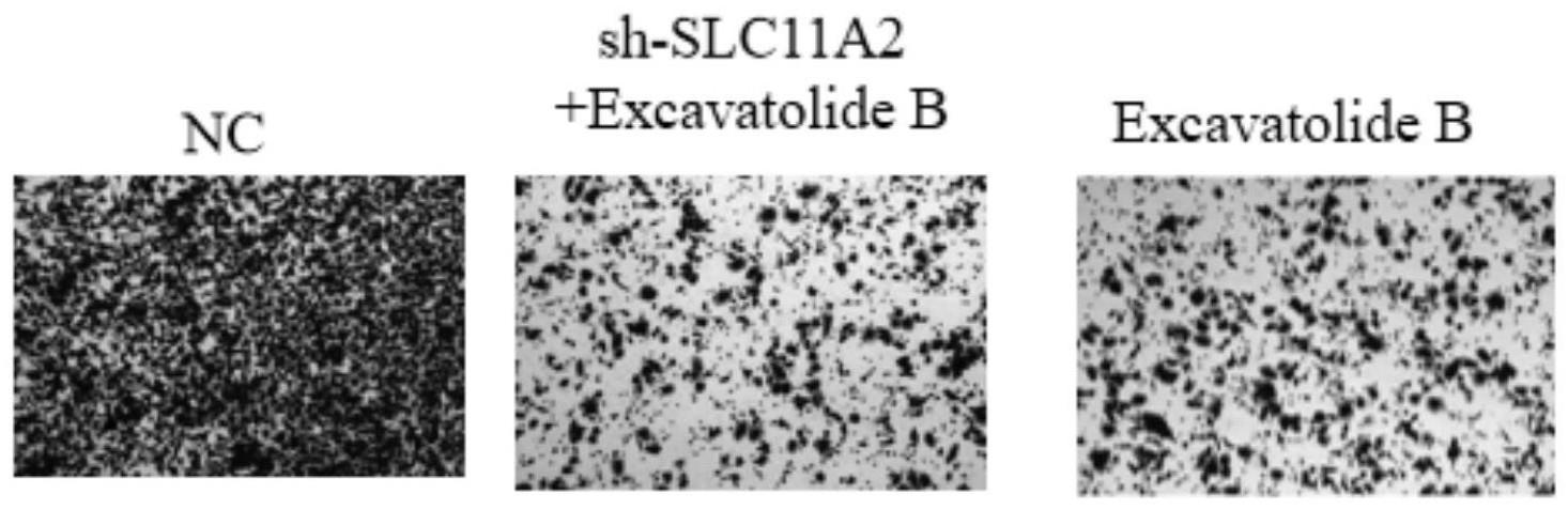 一种靶向SLC11A2的抑制剂及其应用