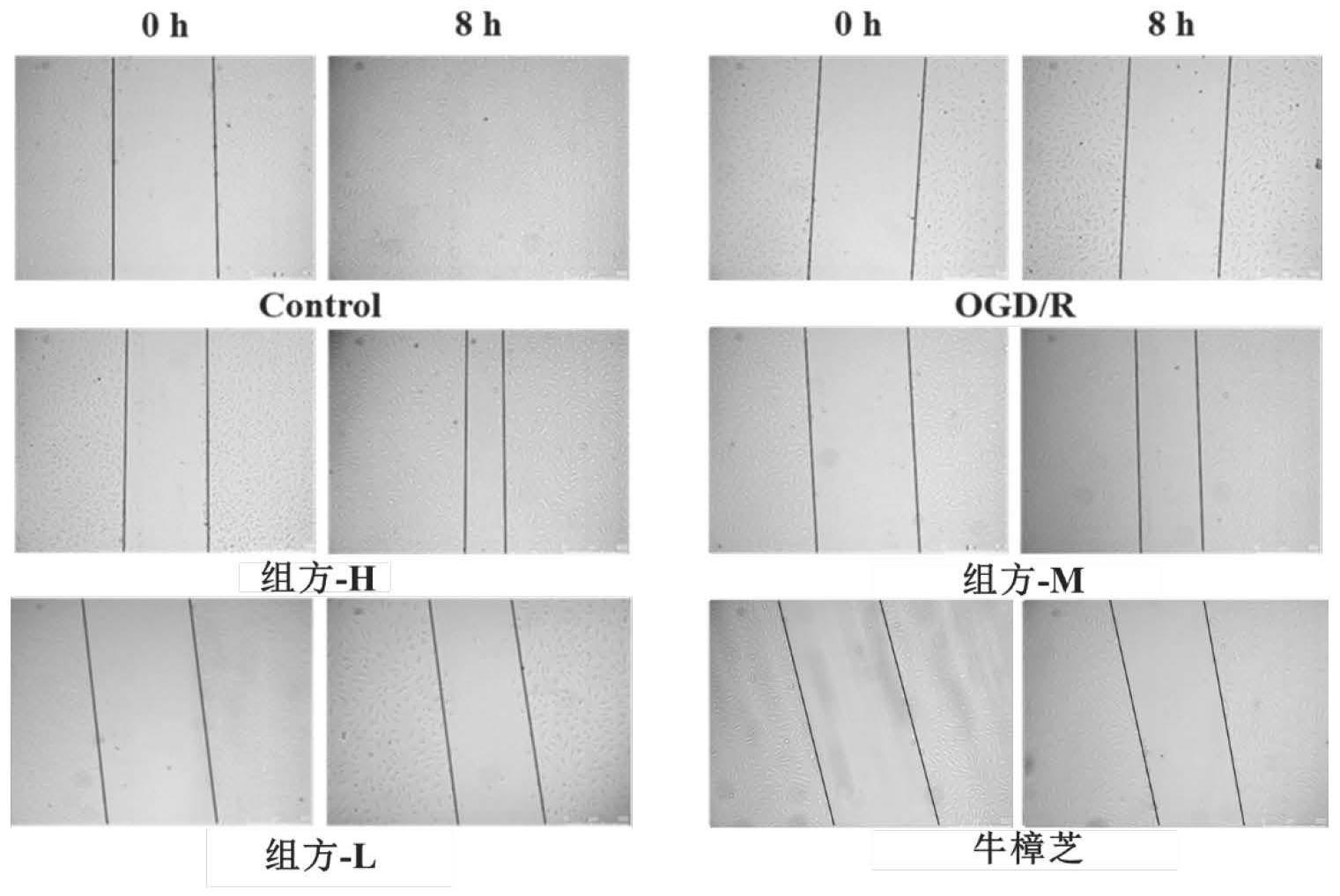 一种治疗脑卒中的药物组合物及其制备方法和用途