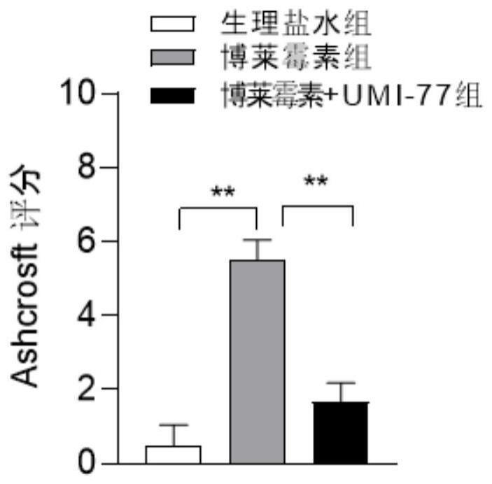 化合物UMI-77在制备治疗肺纤维化药物中的应用