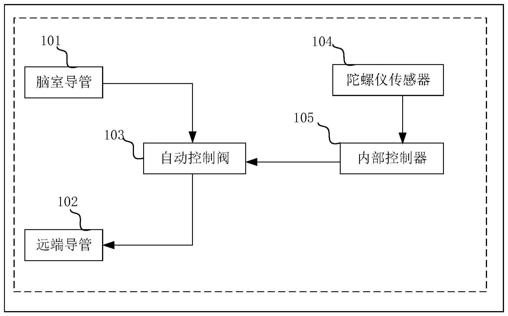 脑脊液分流系统及其控制方法、控制装置和存储介质与流程