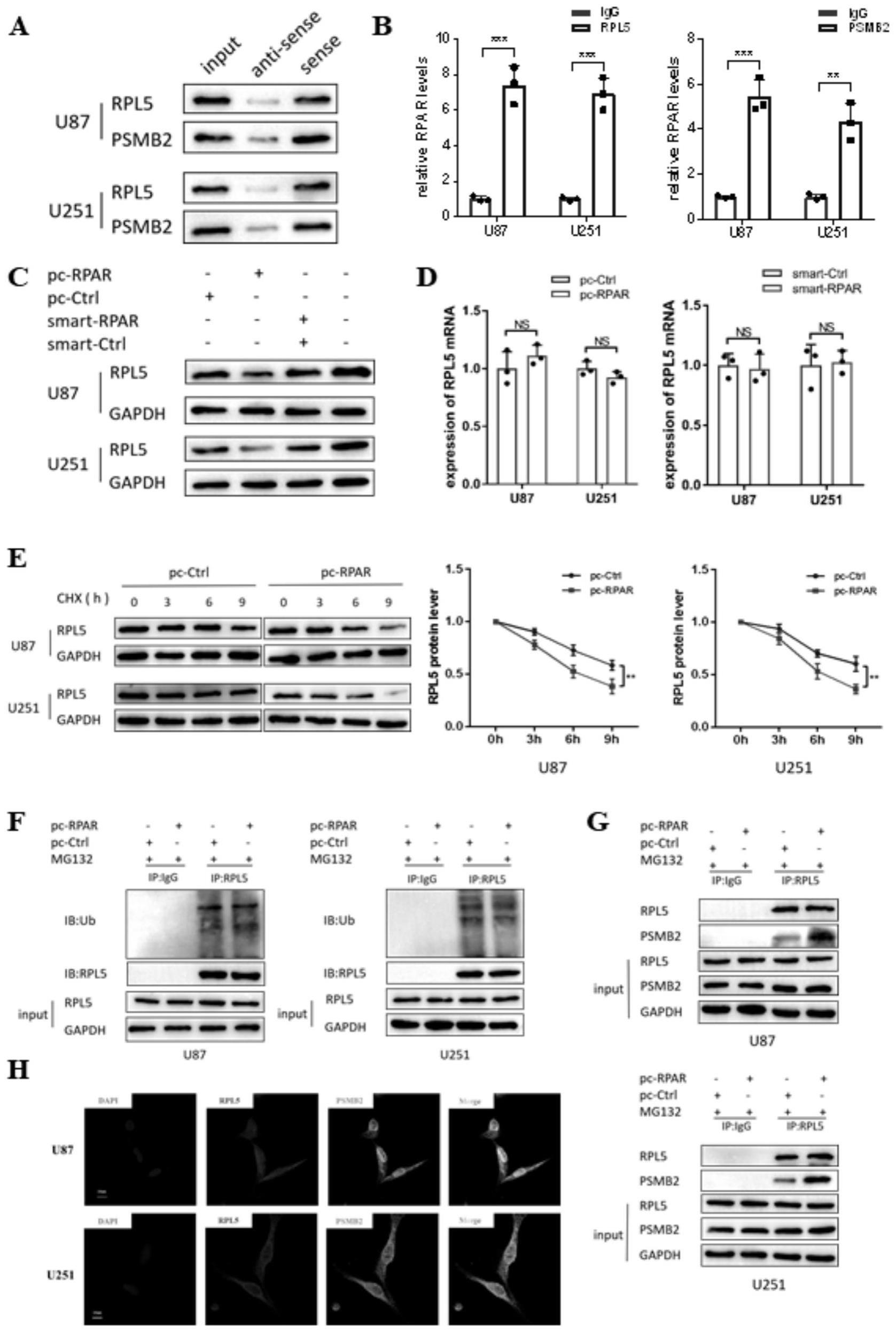 LncRNARPAR在胶质瘤诊治中的应用