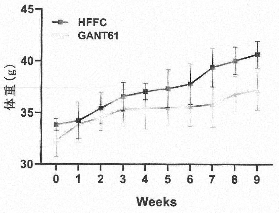 GANT61或其衍生物在制备治疗和/或预防非酒精性脂肪肝疾病中的应用