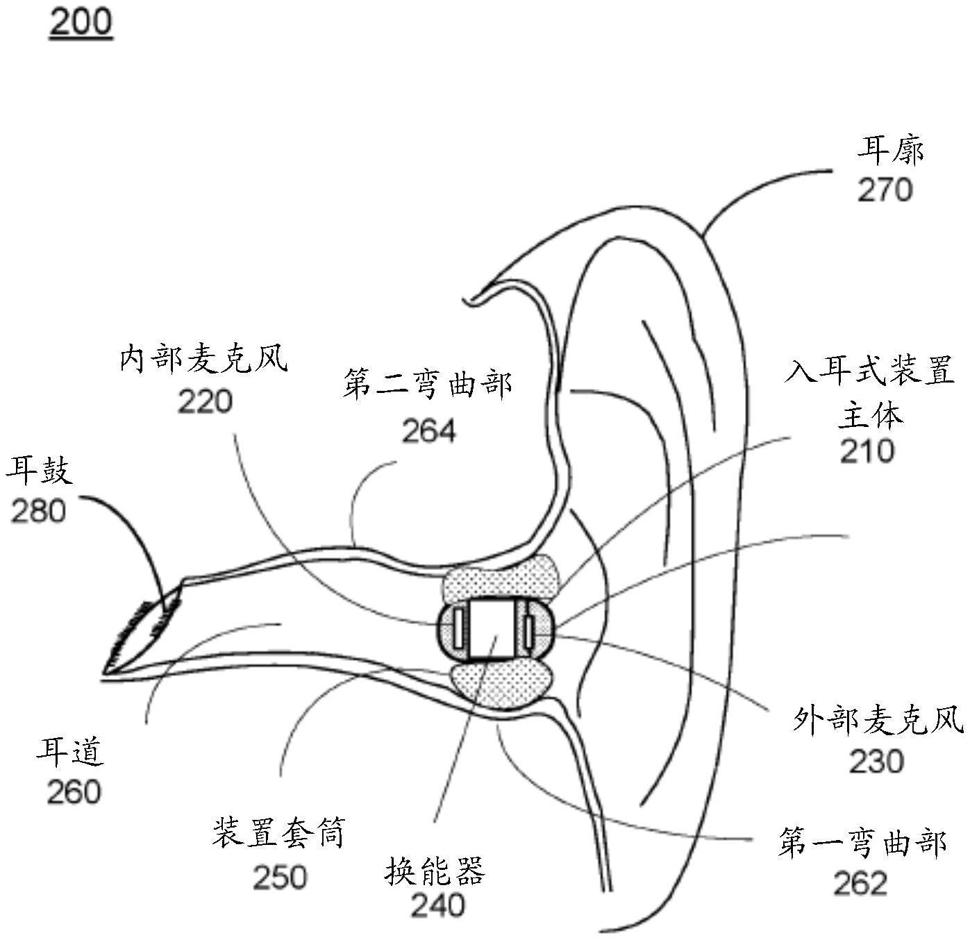 用于全入耳式监听器的超小型动态扬声器的制作方法