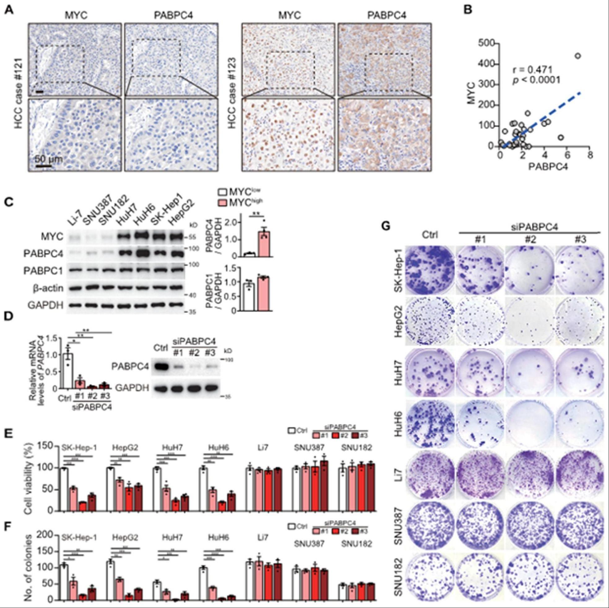 靶向PABPC4的siRNA及其在肝癌治疗中的应用
