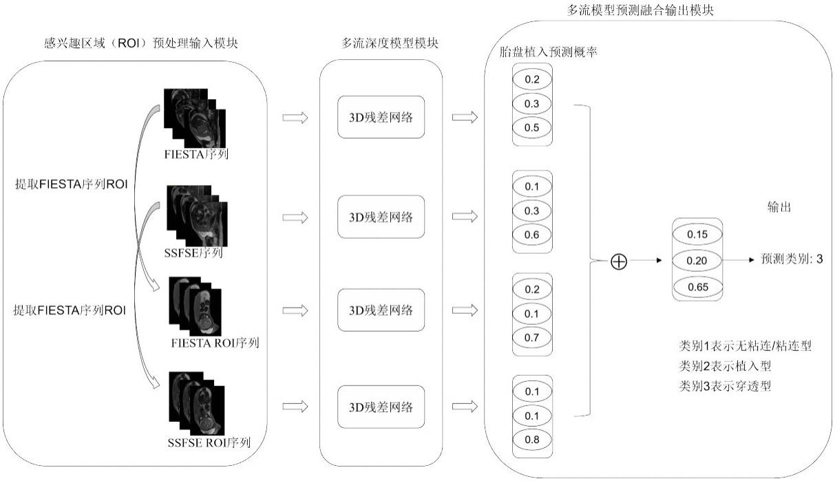 一种胎盘植入分型评估工具和方法