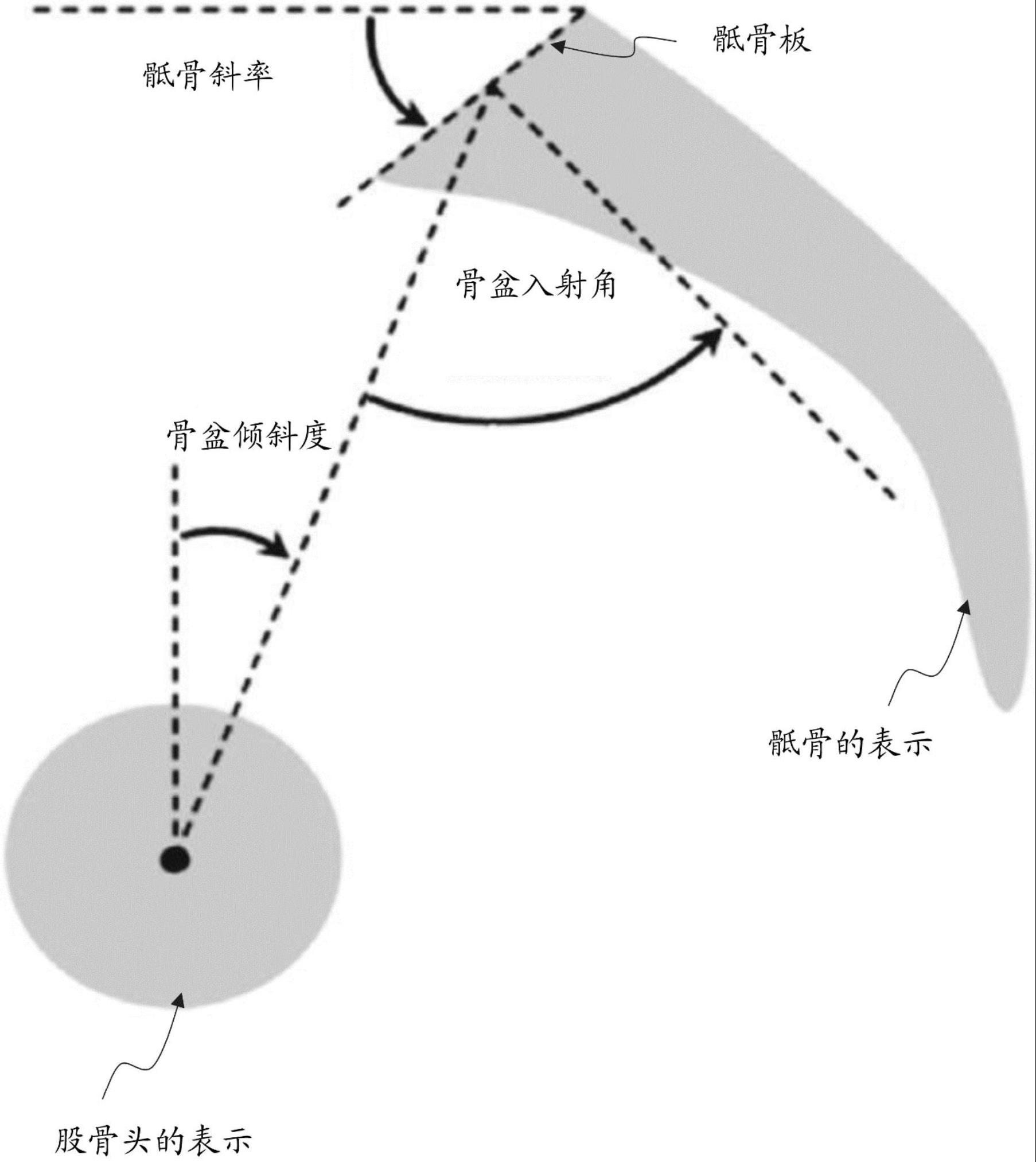 用于分析髋臼杯位置的系统和方法与流程