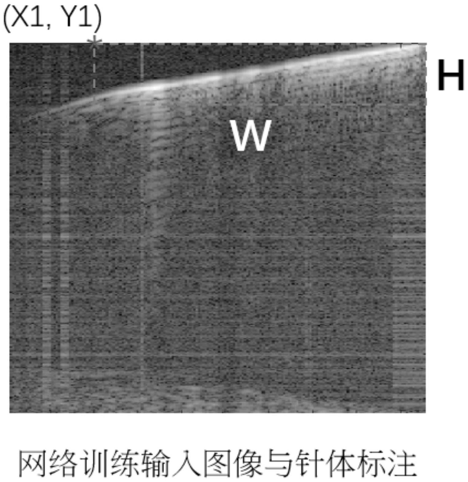 一种超快超声穿刺增强成像方法与流程