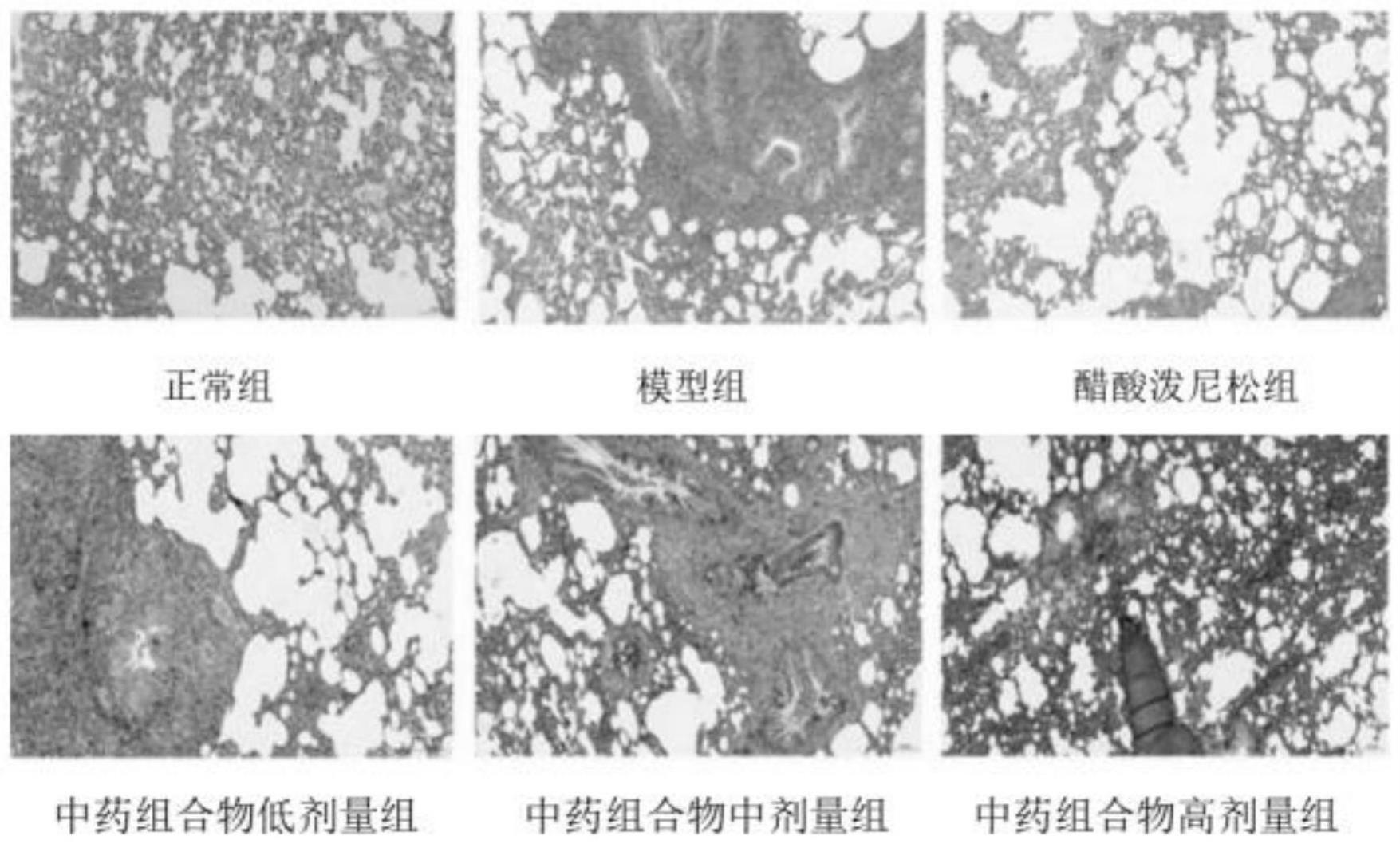 一种药物组合物治疗肺结节的新用途的制作方法