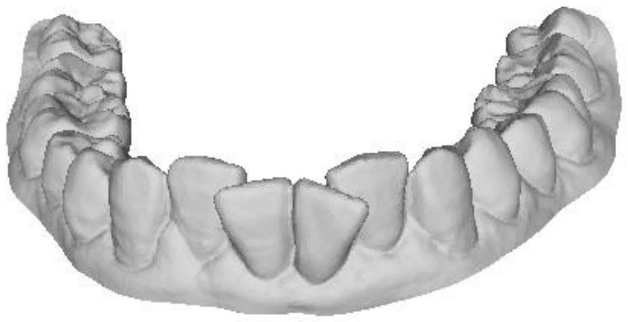 自动裁剪口扫牙模提取感兴趣区域面片的方法及系统与流程