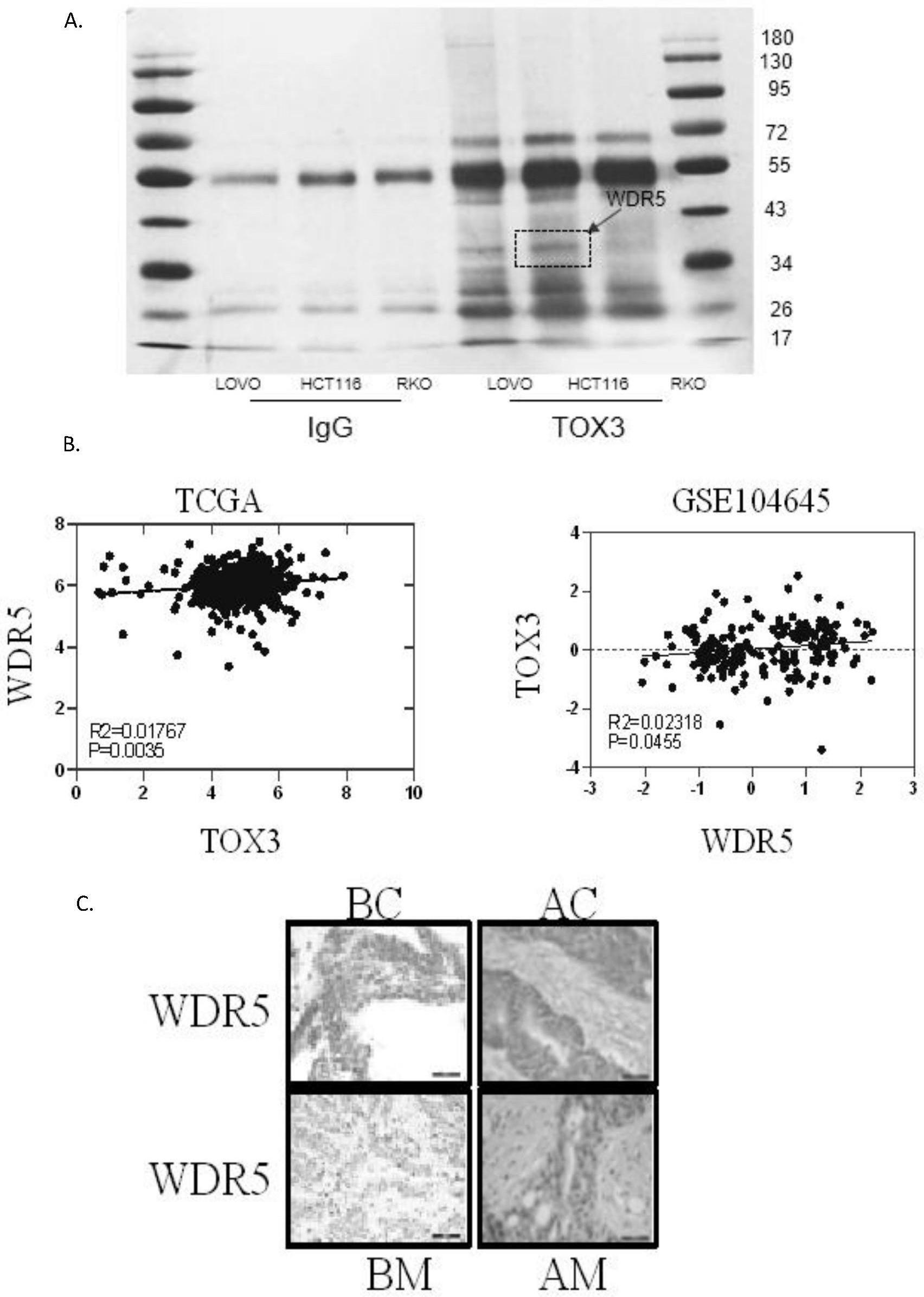 抑制TOX3蛋白与WDR5蛋白的结合在抗结肠癌药物中的应用的制作方法