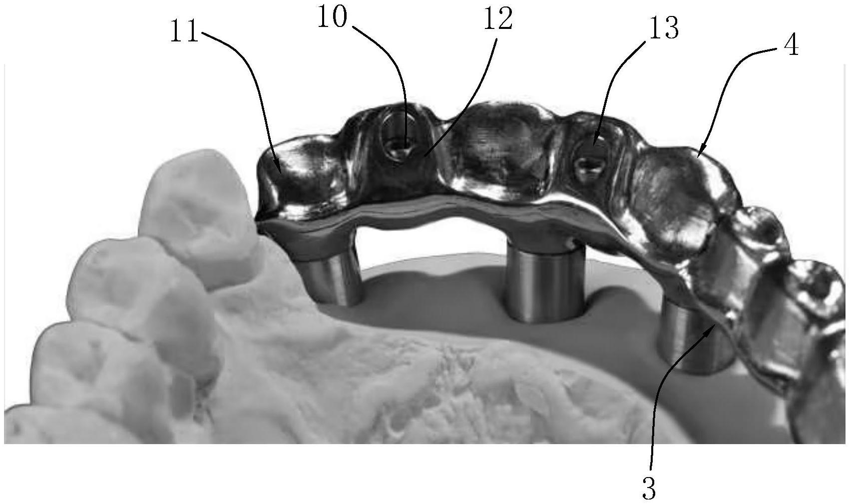一种齿科修复体结构的制作方法