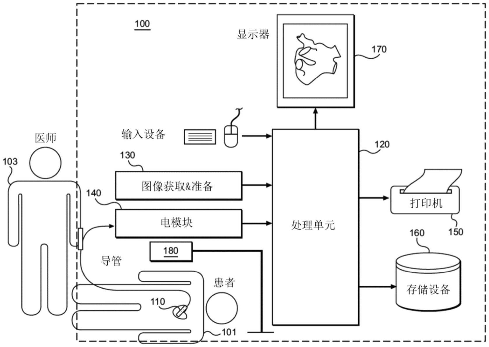 用于评估小折返位点的电生理学系统和方法与流程