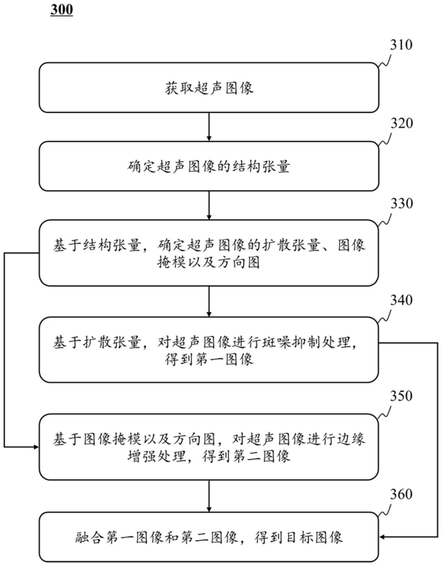 一种超声图像增强方法和系统与流程