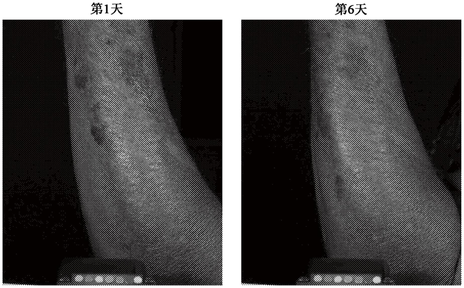 与老化皮肤有关的组合物和方法与流程