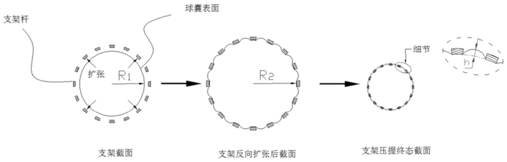 一种血管支架系统及其制备方法与流程